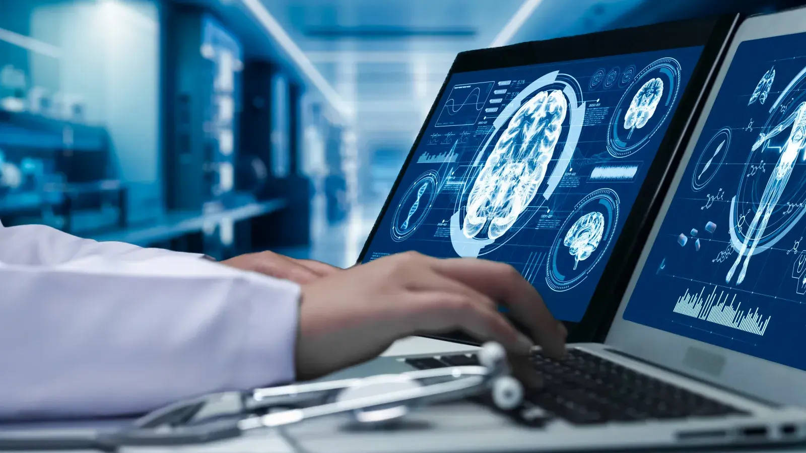 Cómo la geometría del cerebro anticiparía la demencia años antes de los primeros síntomas