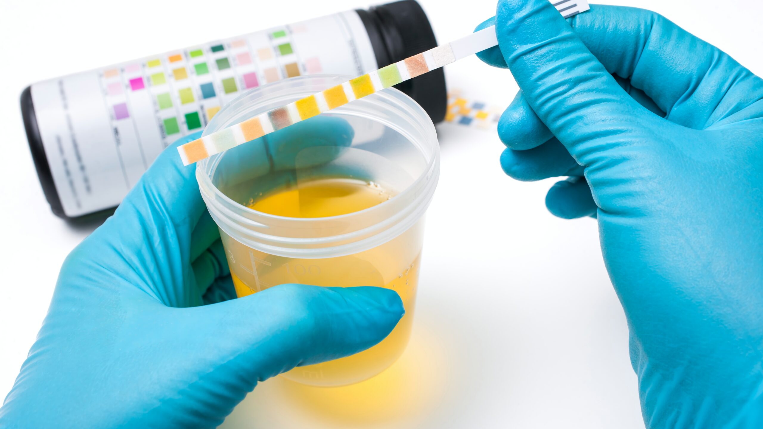 Buscan implementar pruebas de detección renal en centros de trabajo